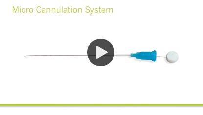 Kannülierungssystem link